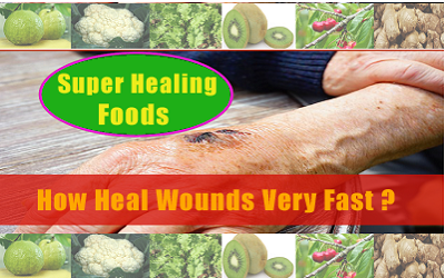 How To Heal Wounds Faster